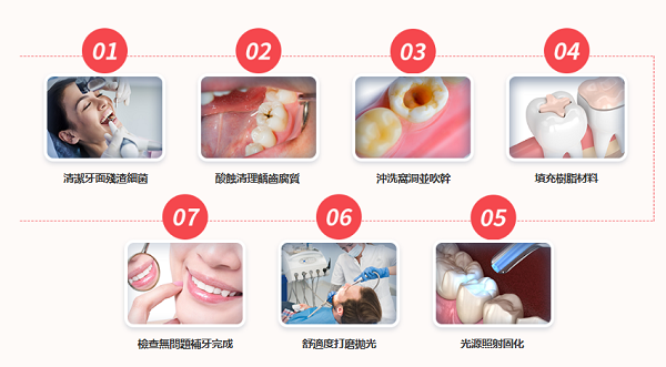 深圳補牙幾多錢一隻